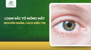 Loạn sắc tố mống mắt