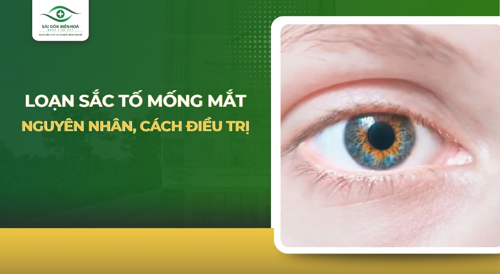 loan-sac-to-mong-mat