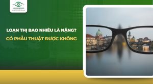 loạn thị bao nhiêu là nặng