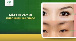 Mắt 1 mí và 2 mí