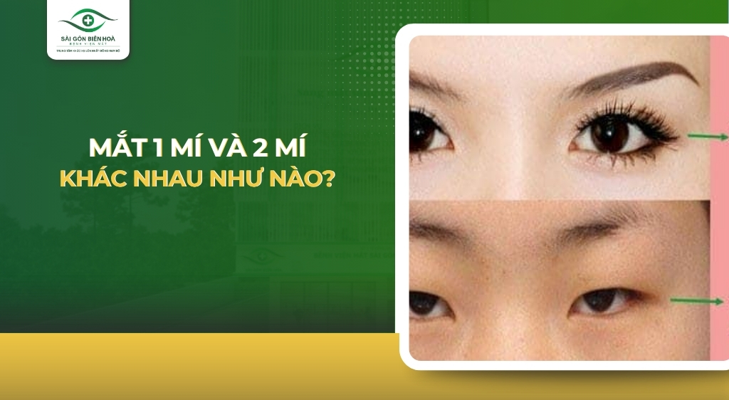 Mắt 1 mí và 2 mí