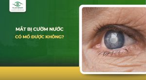 mắt bị cườm nước