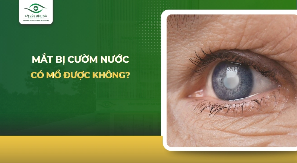 mat-bi-cuom-nuoc-co-mo-duoc-khong (1)