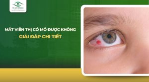 Mắt viễn thị có mổ được không