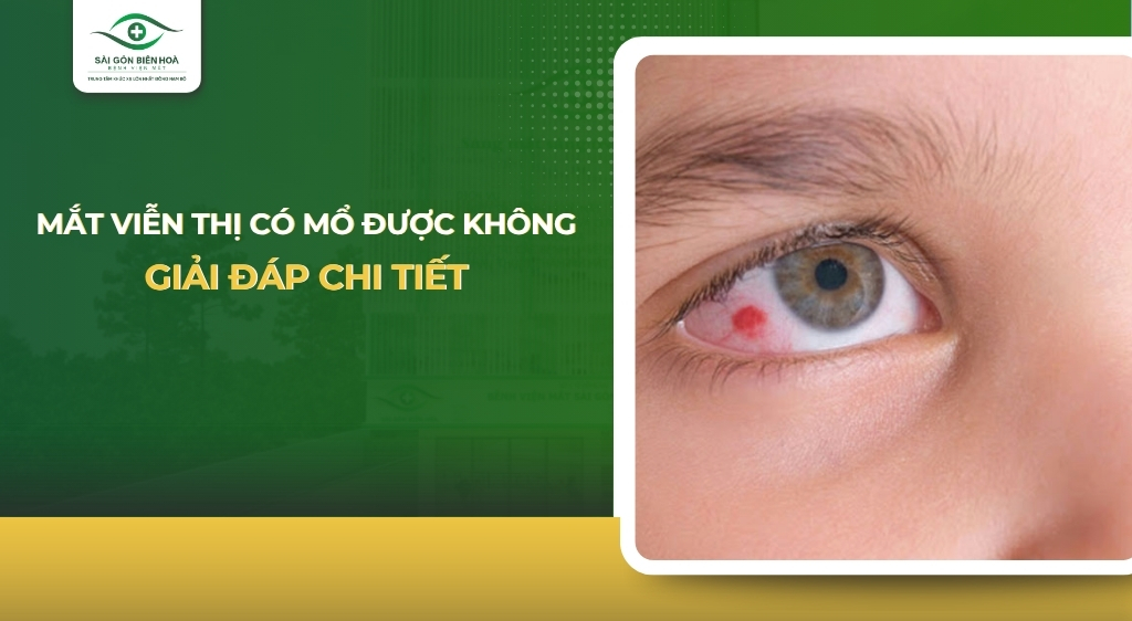 Mắt viễn thị có mổ được không