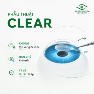 Mổ cận CLEAR