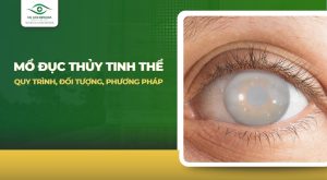 mo-duc-thuy-tinh-the