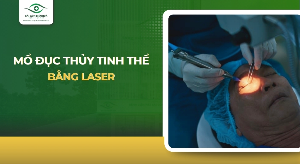mo-duc-thuy-tinh-the-bang-laser