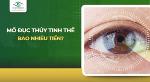 Mổ đục thủy tinh thể bao nhiêu tiền