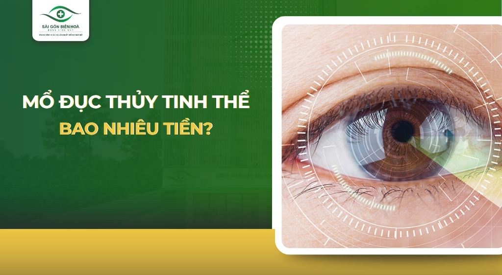 mo-duc-thuy-tinh-the-bao-nhieu-tien