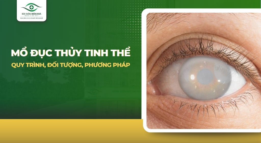 mo-duc-thuy-tinh-the