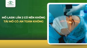 Mổ lasik lần 2 có nên không? Tái mổ có an toàn không?
