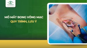 mổ mắt bong võng mạc