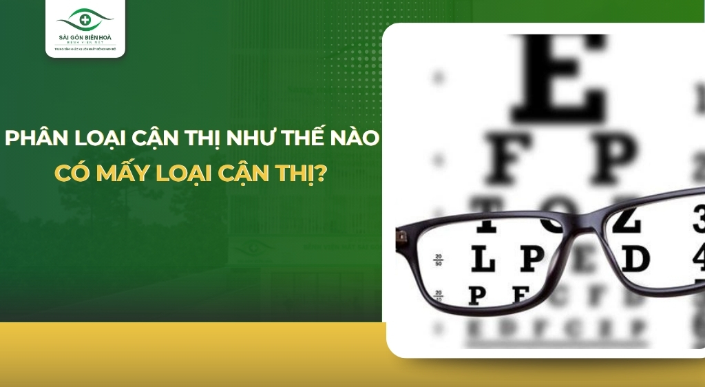 Phân loại cận thị