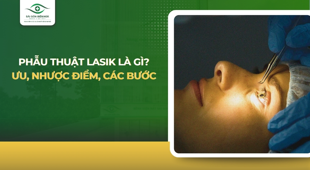 phau-thuat-lasik