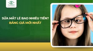 sửa mắt lé bao nhiêu tiền