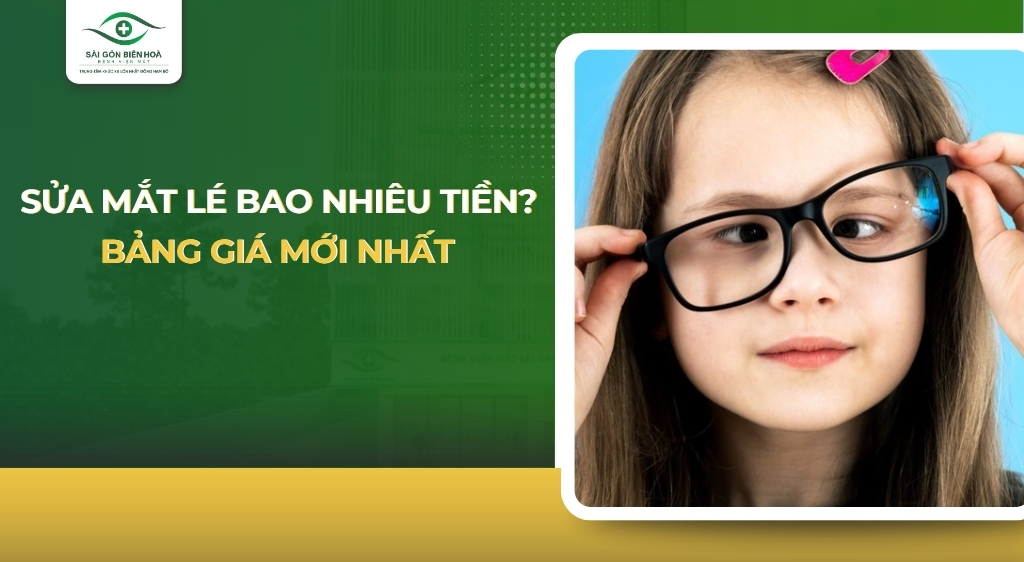 sửa mắt lé bao nhiêu tiền