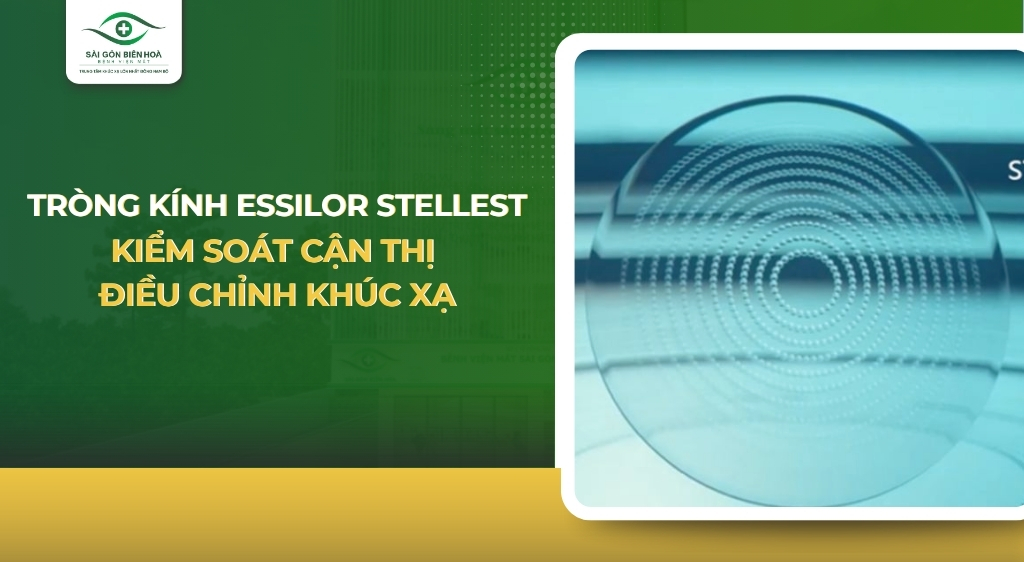 trong-kinh-essilor-stellest