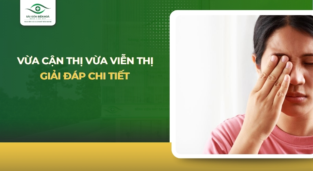 vừa cận thị vừa viễn thị