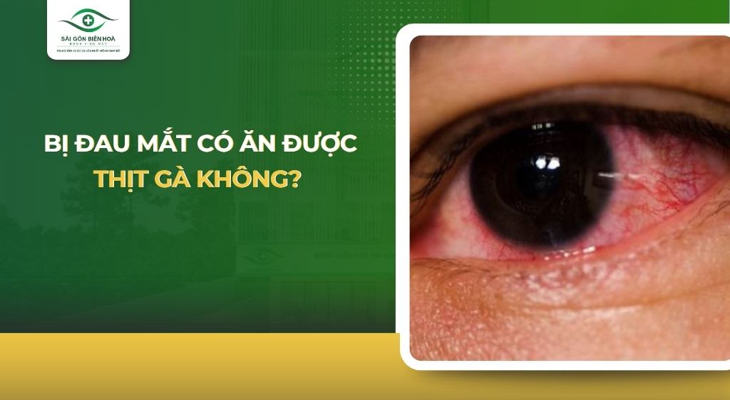 bị đau mắt có ăn được thịt gà không