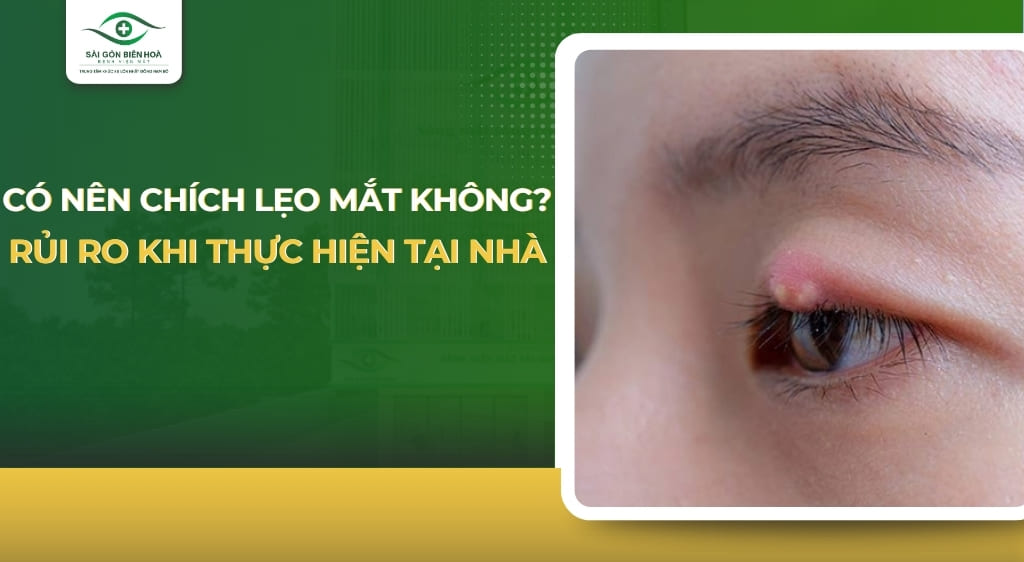 có nên chích lẹo mắt không