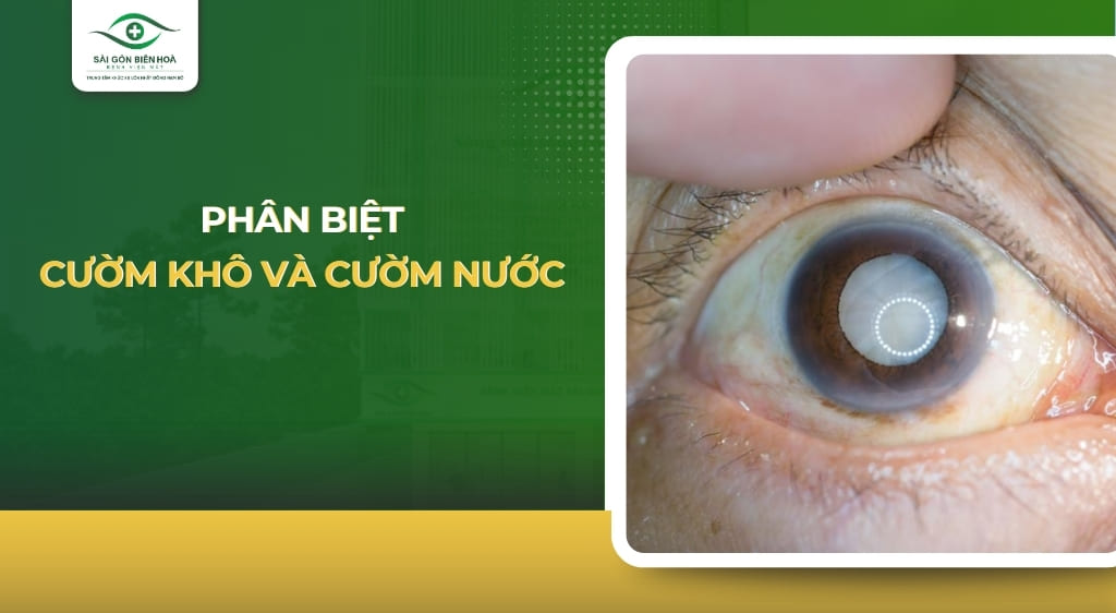 cườm khô và cườm nước