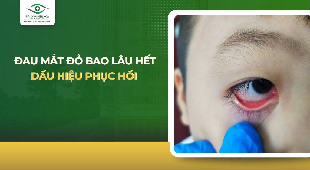 đau mắt đỏ bao lâu hết