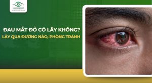 đau mắt đỏ có lây không