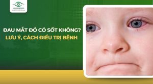Đau mắt đỏ có sốt không