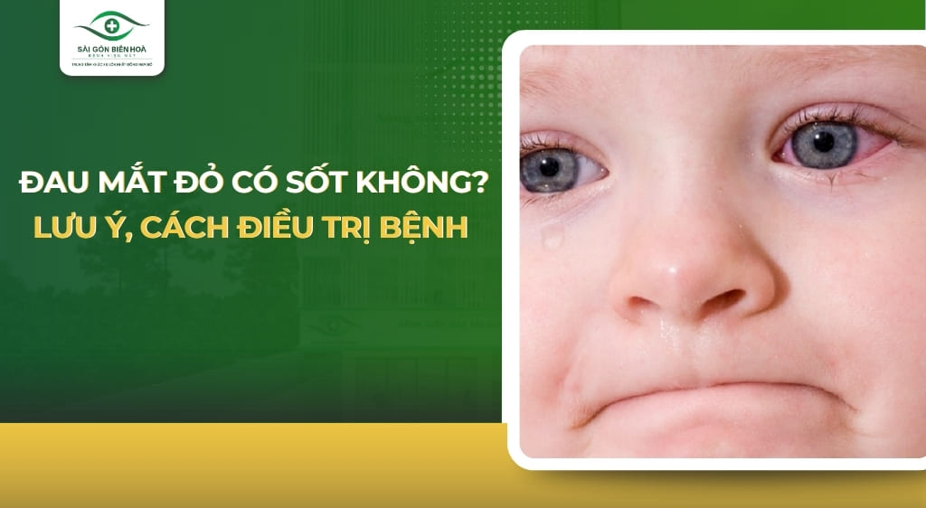 Đau mắt đỏ có sốt không