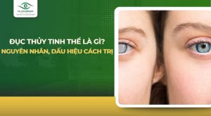 Đục thủy tinh thể