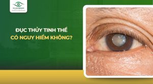 đục thủy tinh thể có nguy hiểm không