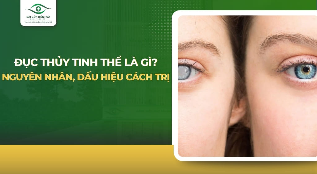 Đục thủy tinh thể