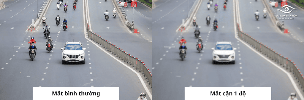 Góc nhìn của người cận 1 độ