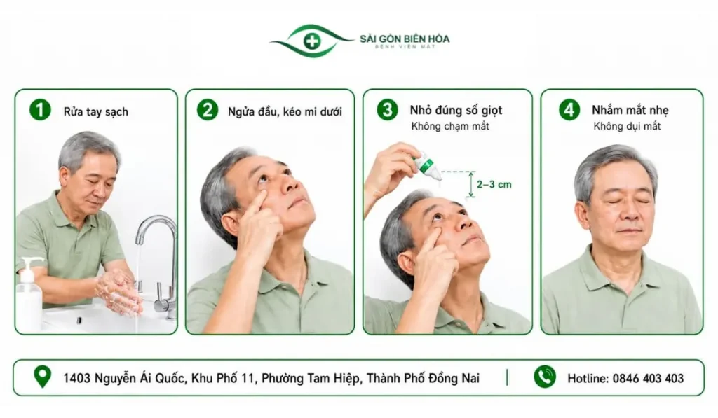 Hướng dẫn từng bước nhỏ thuốc đúng cách sau phẫu thuật Phaco