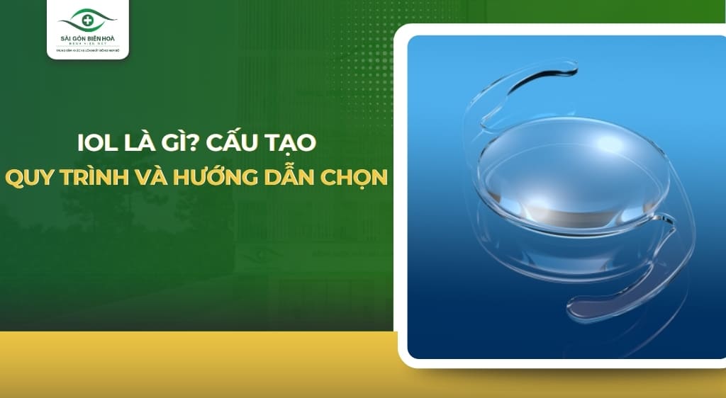 IOL là gì