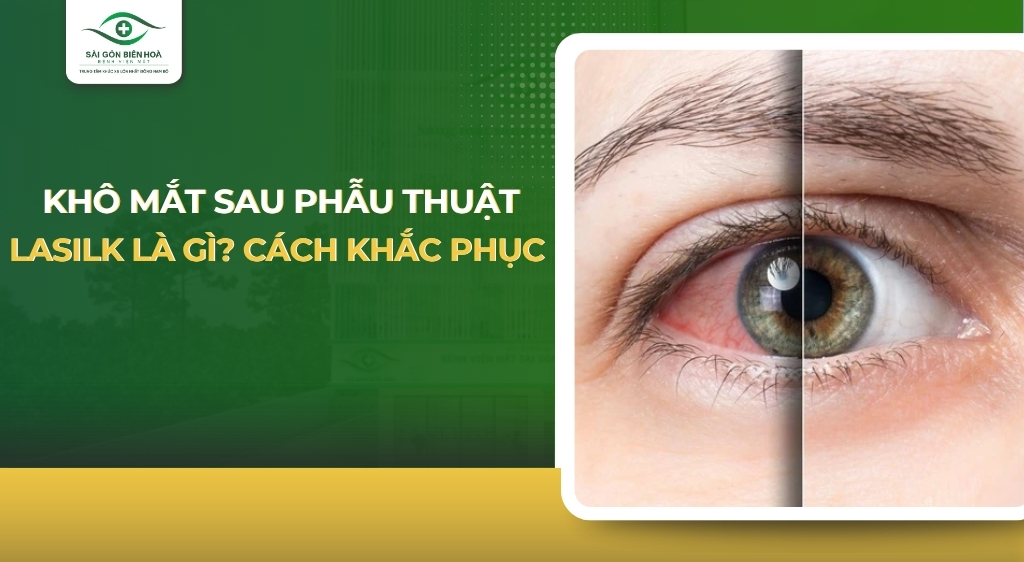 khô mắt sau phẫu thuật lasik