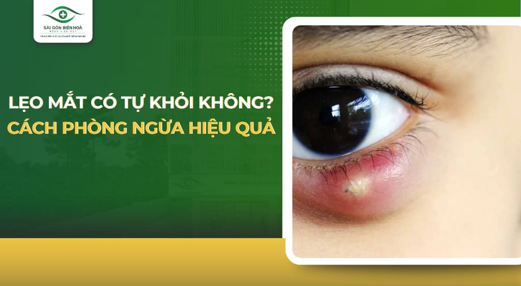 lẹo mắt có tự khỏi không