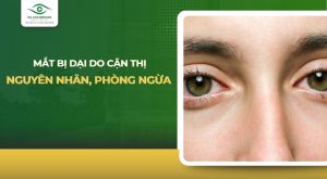 mắt bị dại