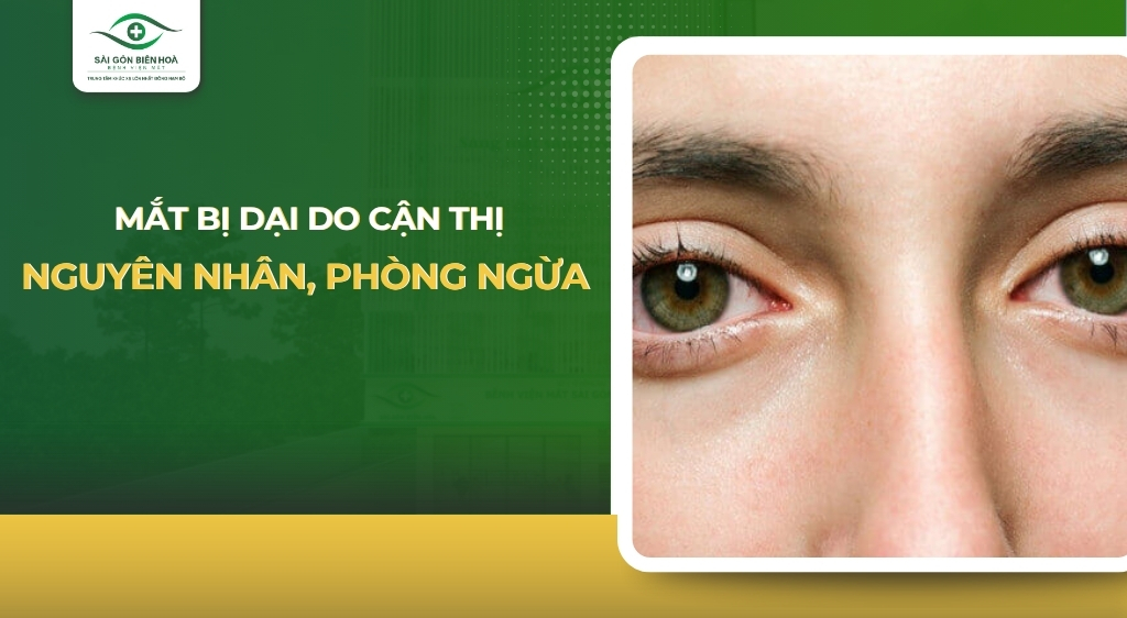 mắt bị dại