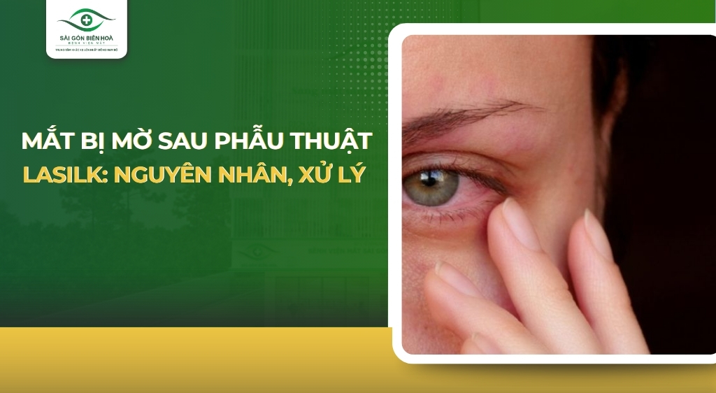 mắt bị mờ sau phẫu thuật LASIK