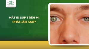 mắt bị sụp 1 bên mí phải làm sao