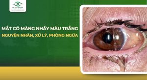 Mắt có màng nhầy màu trắng