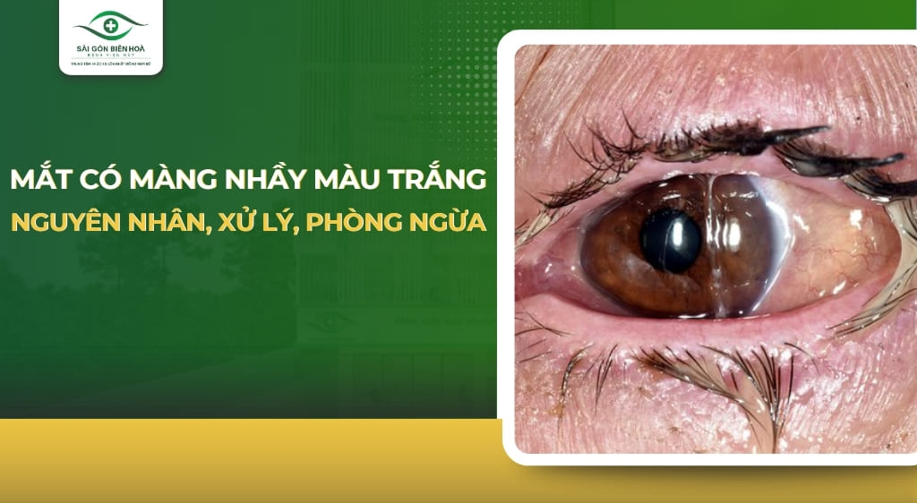 Mắt có màng nhầy màu trắng
