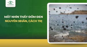 mắt nhìn thấy đốm đen