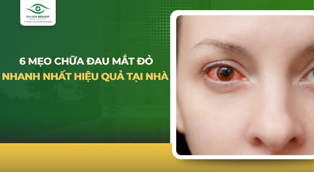 mẹo chữa đau mắt đỏ nhanh nhất