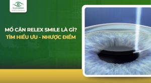 Mổ cận Relex Smile