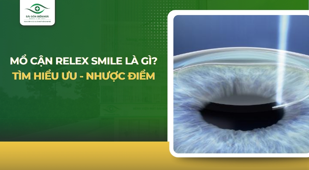 Mổ cận Relex Smile