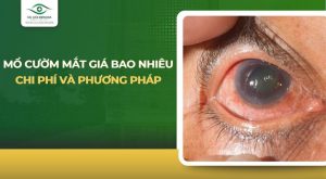 Mổ cườm mắt giá bao nhiêu tiền?