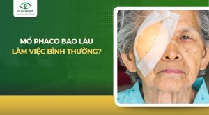 Mổ Phaco bao lâu làm việc bình thường